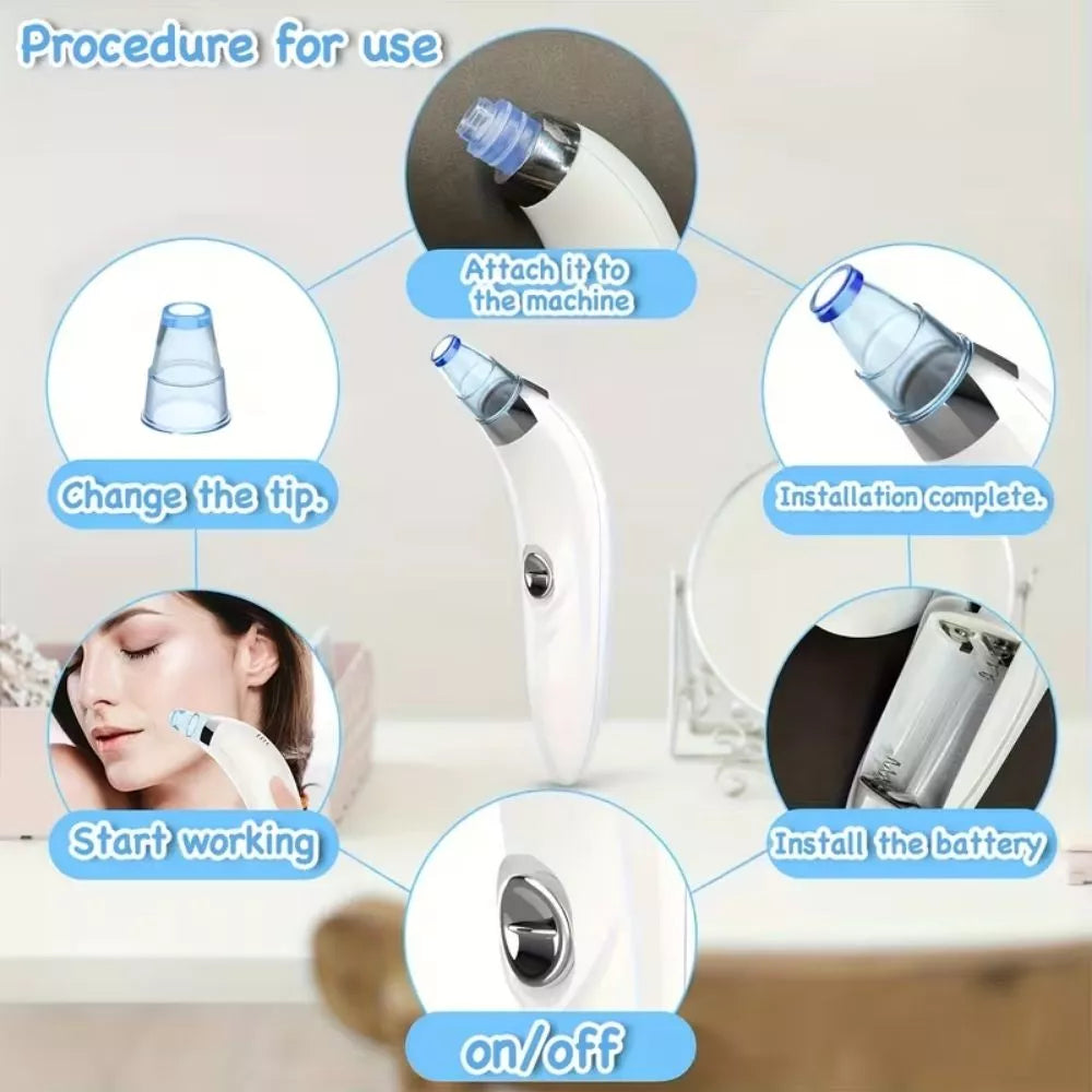 GENAI Portable Blackhead & Pore Cleaner – 4 Probe Facial Cleansing Tool